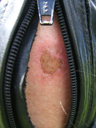 193_tour5_gebranntes_kind